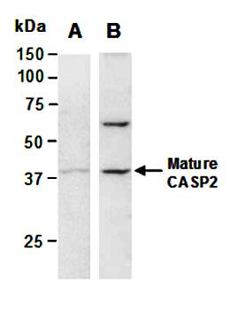 CASP2 (N) Antibody, Rabbit Polyclonal