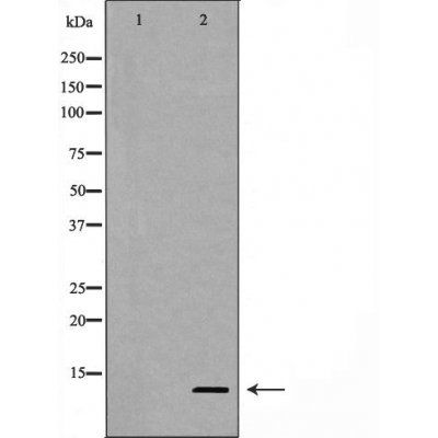 Cleaved-Caspase 9 (Asp353) Antibody