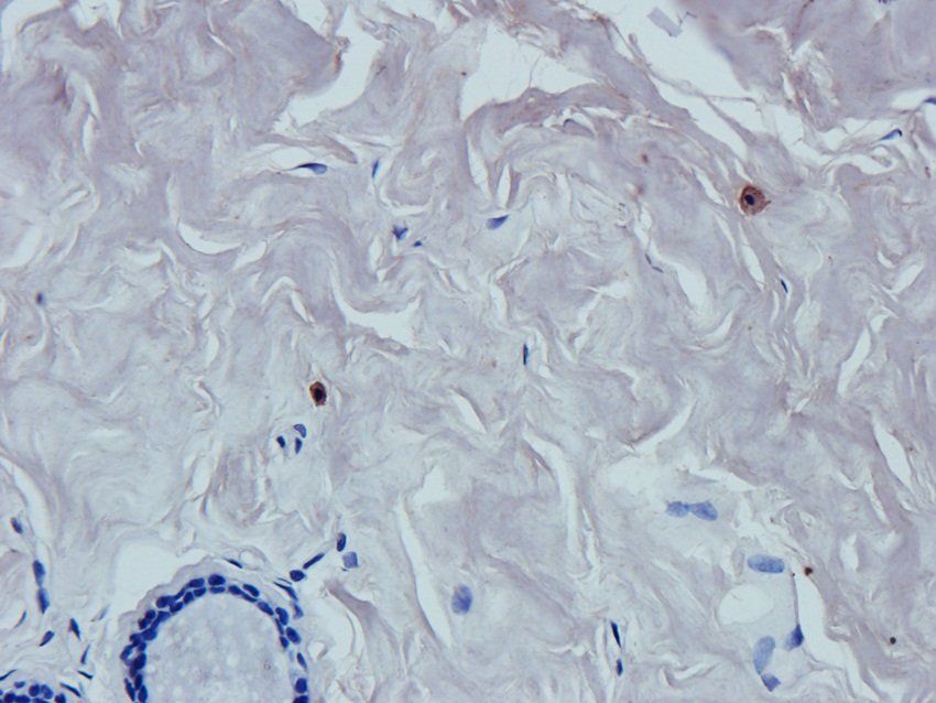 Caspase 3 Rabbit Polyclonal Antibody