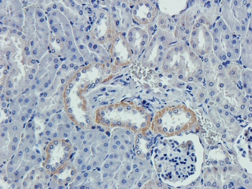 Caspase 3 Rabbit Polyclonal Antibody