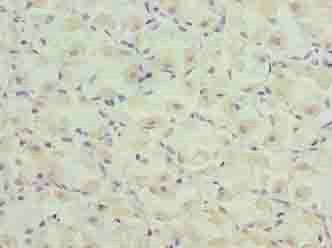 CASQ1 Antibody