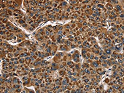 CAT Antibody