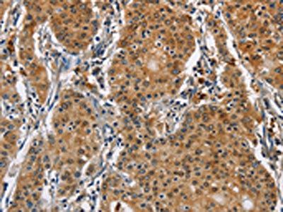 CAT Antibody