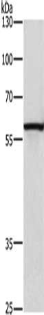 CAT Antibody