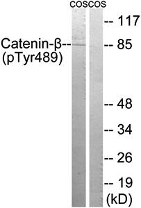 Catenin-β (Phospho-Tyr489) Antibody