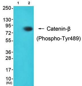 Catenin-β (Phospho-Tyr489) Antibody