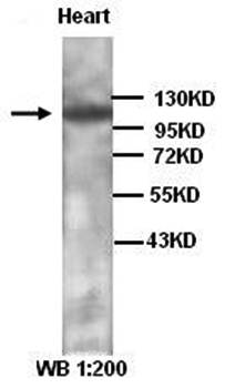Alpha T Catenin Rabbit Polyclonal Antibody