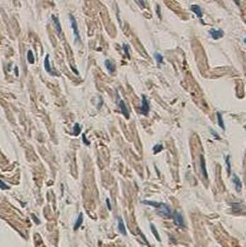 Alpha T Catenin Rabbit Polyclonal Antibody