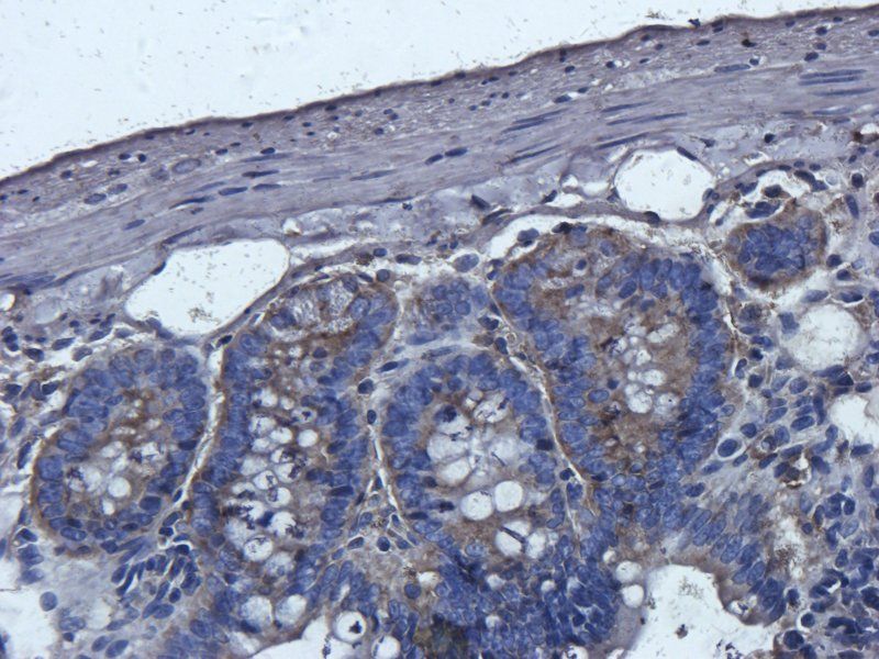 Cathepsin G antibody