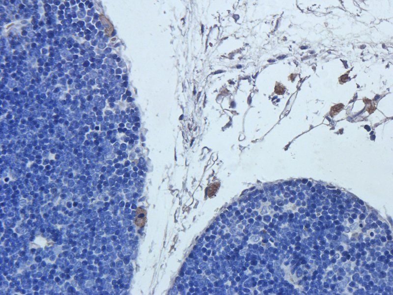 Cathepsin G antibody
