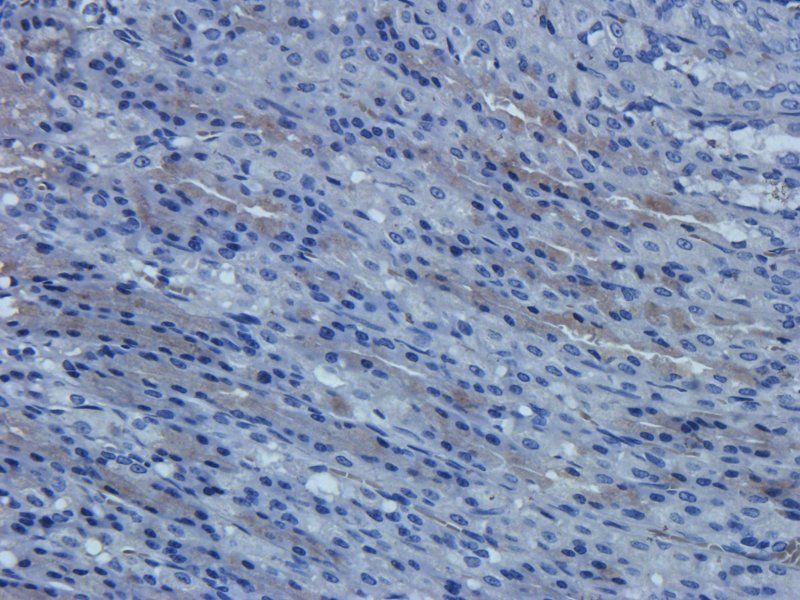 Cathepsin G antibody