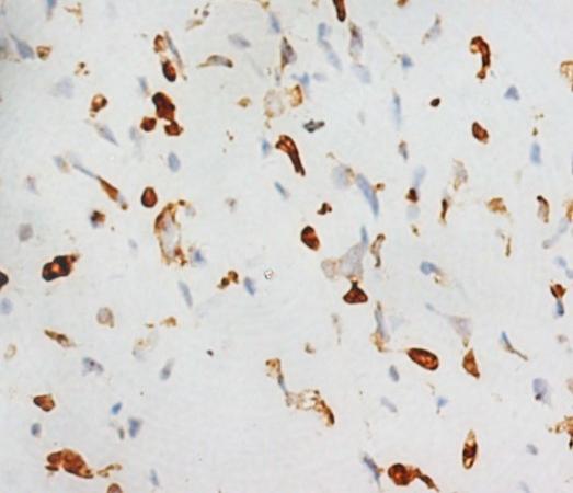 RUNX2 Rabbit Polyclonal Antibody