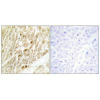 CBFB Antibody
