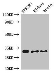 CBR1 Antibody