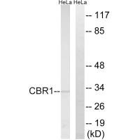 CBR1 Antibody