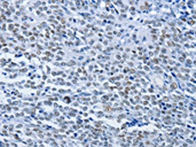 CBX1 Antibody