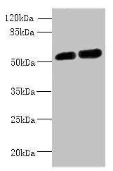 CBX2 Antibody