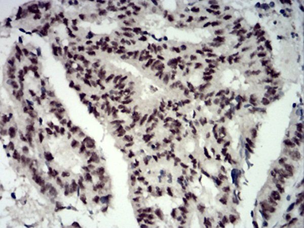 CBX4 Antibody