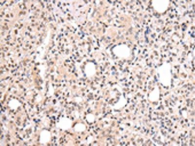 CBX7 Antibody