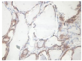 CCDC25 Rabbit Polyclonal Antibody