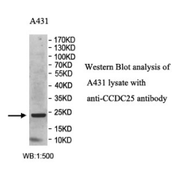 CCDC25 Rabbit Polyclonal Antibody