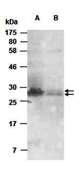CCL1 (C) Antibody, Rabbit Polyclonal