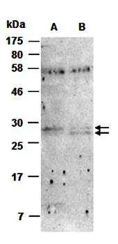 CCL1 (N) Antibody,Rabbit Polyclonal