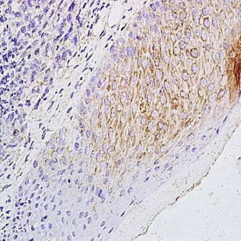 CCL21 Rabbit Polyclonal Antibody