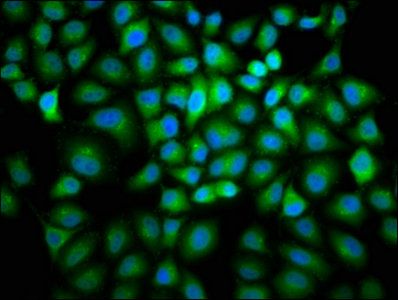 CCNB2 Antibody