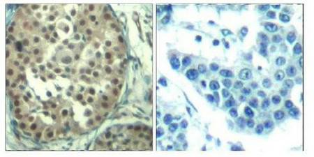 CCNE1 Antibody