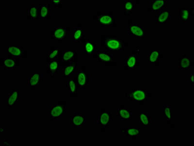 CCNE1 Antibody