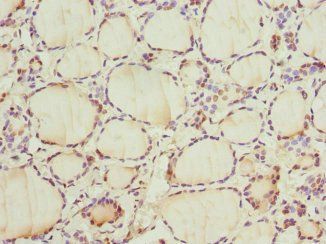CCNE2 Antibody