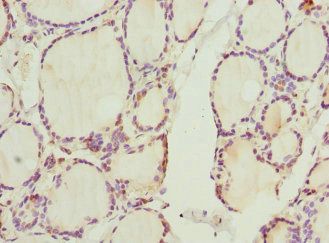 CCNE2 Antibody
