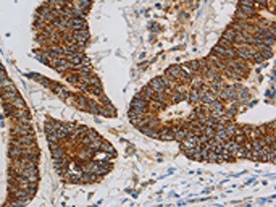 CCNF Antibody