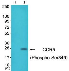 CCR5 (Phospho-Ser349) Antibody