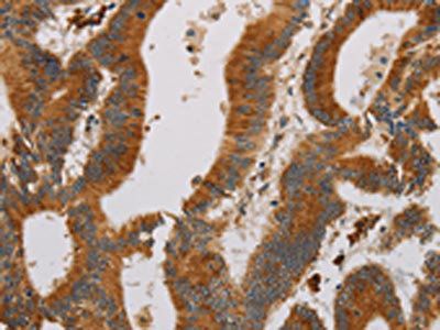 CCR8 Antibody