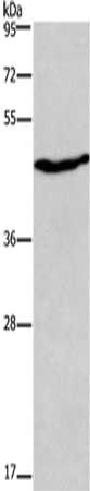 CCR8 Antibody