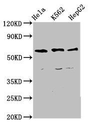 CCT5 Antibody