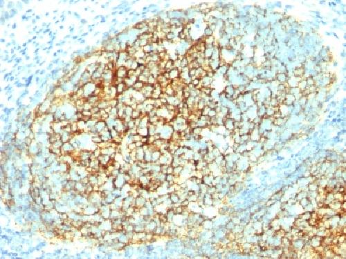 VCAM1 Antibody