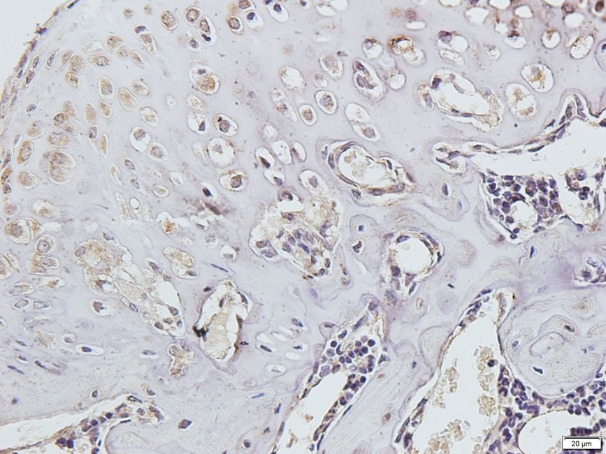 CD11A Rabbit Polyclonal Antibody