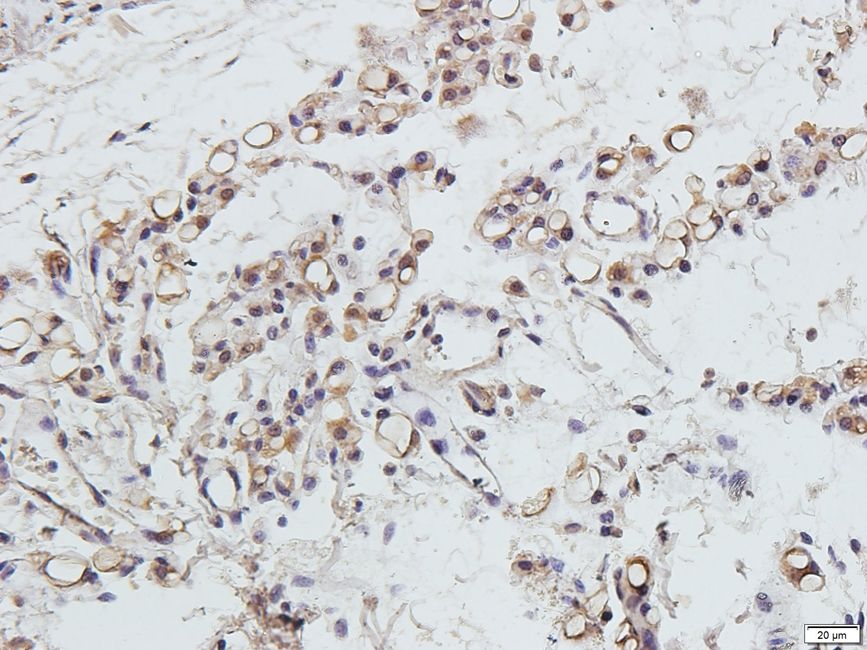 CD11A Rabbit Polyclonal Antibody