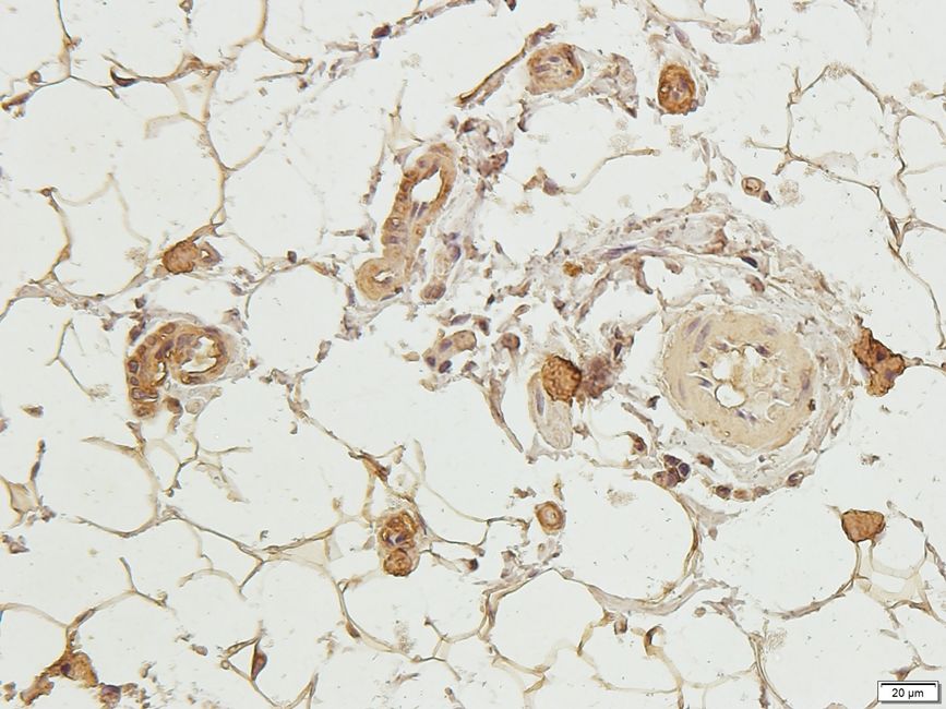 CD11A Rabbit Polyclonal Antibody