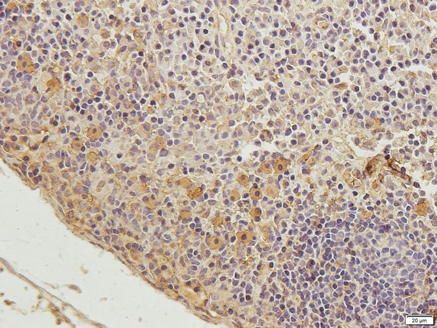 CD11A Rabbit Polyclonal Antibody