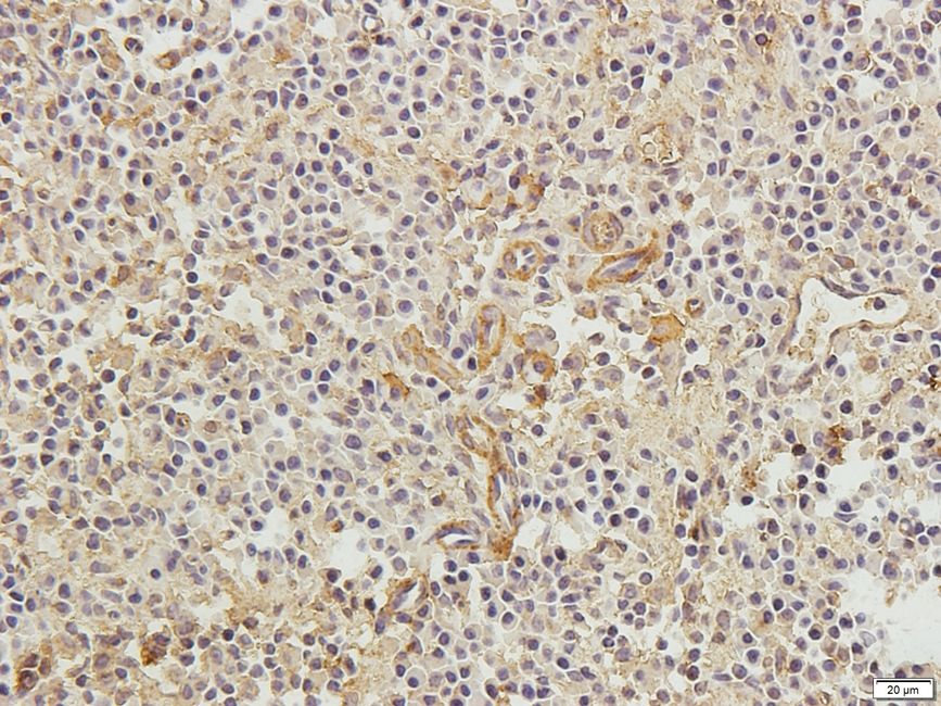 CD11A Rabbit Polyclonal Antibody