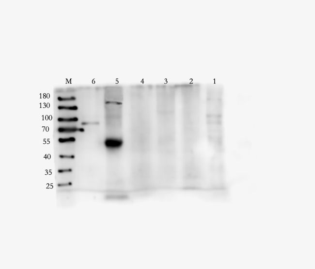 CD11A Rabbit Polyclonal Antibody