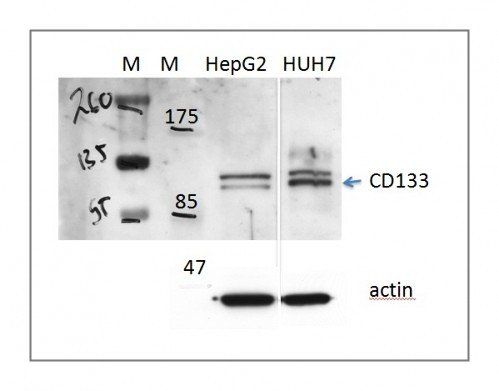 CD133 antibody