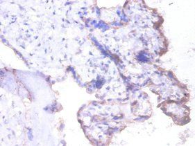 BSG Antibody
