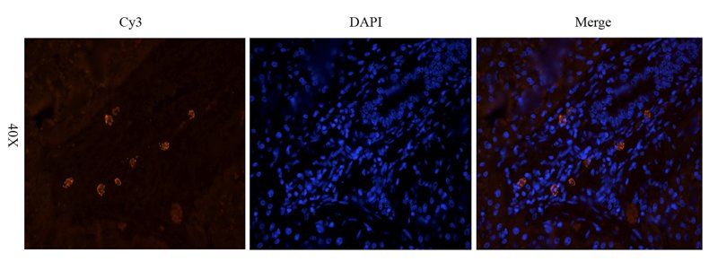 CD14 Rabbit Polyclonal Antibody