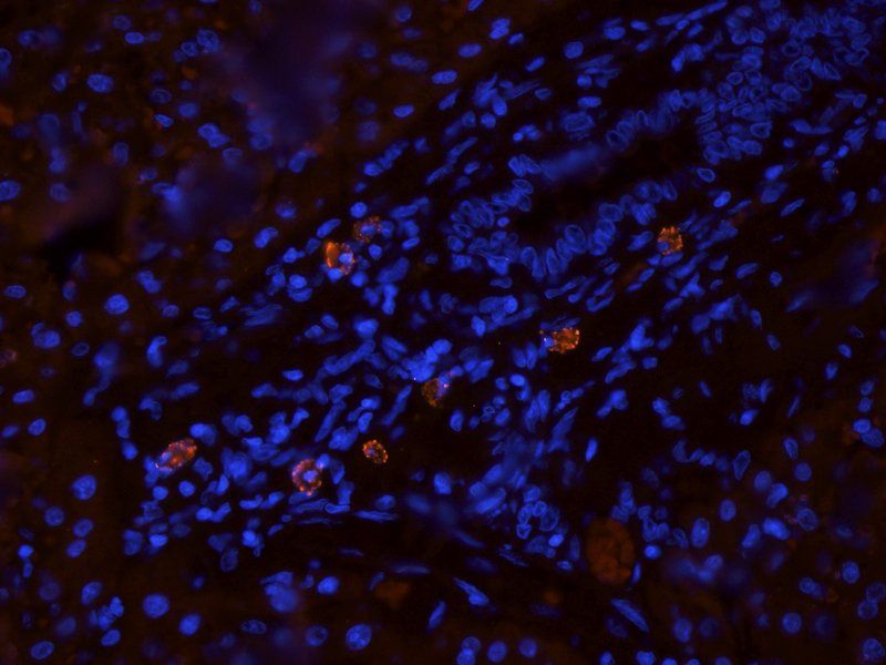 CD14 Rabbit Polyclonal Antibody