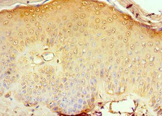 CD1A Antibody